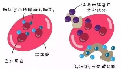 警惕洗澡季隱形殺手 一氧化碳中毒康復(fù)后，當心遲發(fā)性腦病
